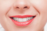 40代女性におススメの歯のホワイトニング
